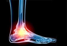 Foot and Ankle Trauma