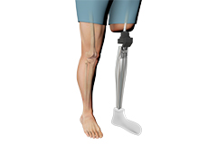 Osseointegration